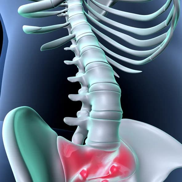 Lumbar spinal stenosis treatment illustration