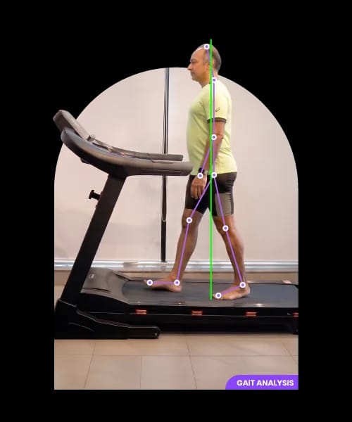 Gait analysis on a treadmill with joint tracking overlay
