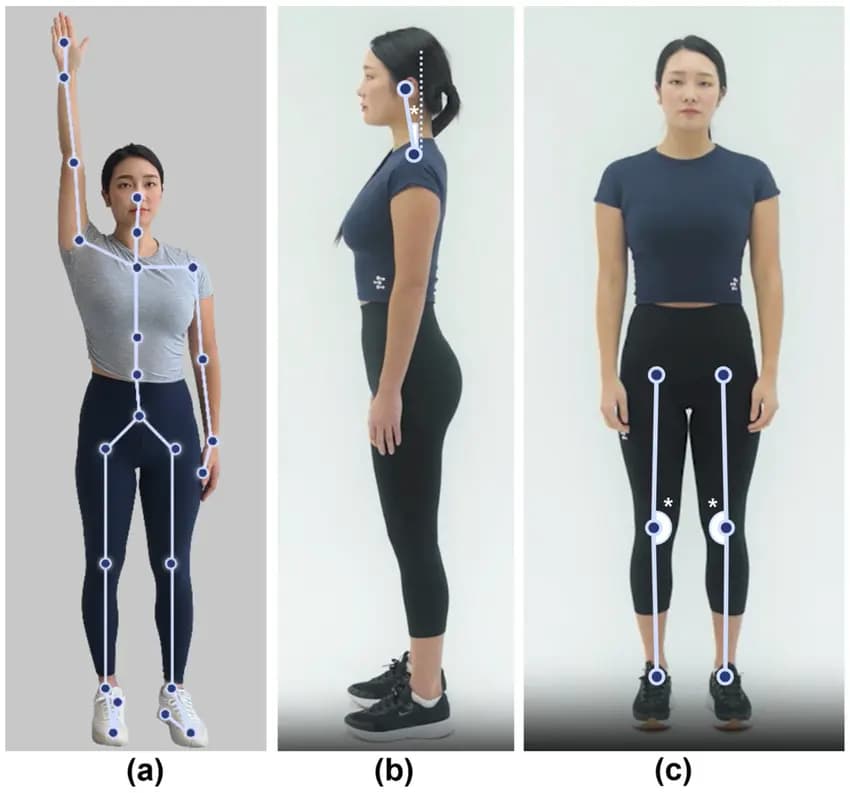 AI Postural Assessment