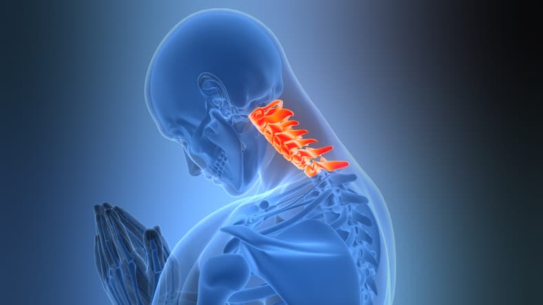 Cervical Spinal Canal Stenosis