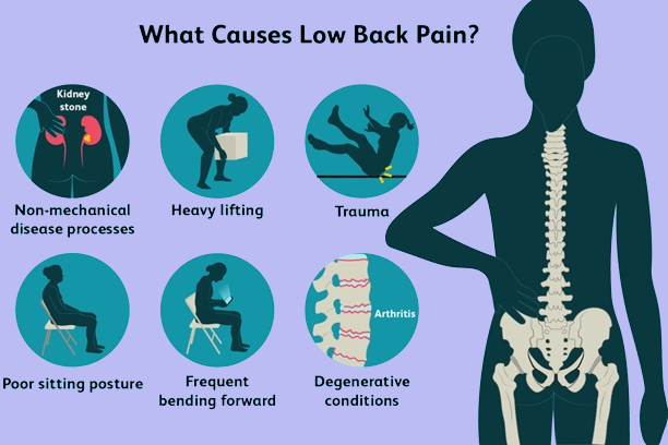 Back Pain Symptoms and Causes.png