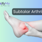Subtalar Arthritis