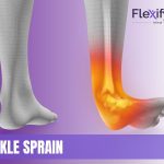 Ankle sprain