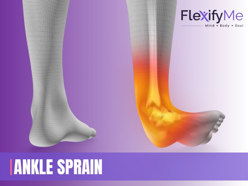 Ankle sprain