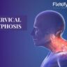 Cervical Kyphosis