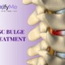 Disc Bulge