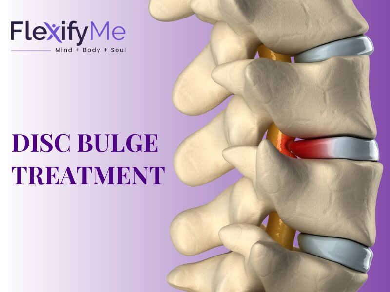 Disc Bulge