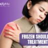 Frozen Shoulder Treatment