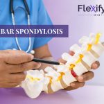 Lumbar Spondylosis