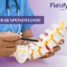 Lumbar Spondylosis