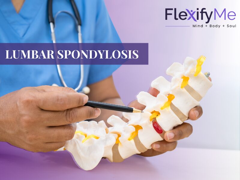 Lumbar Spondylosis