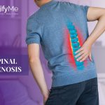 spinal stenosis