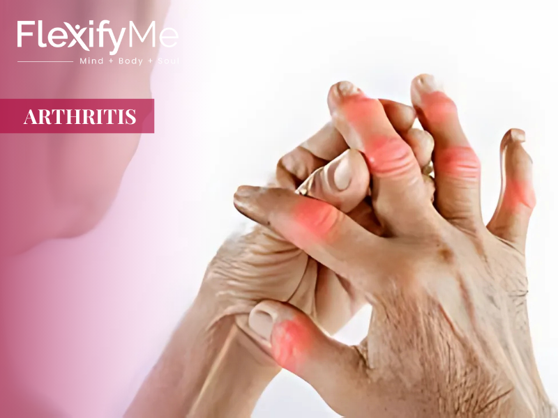 Arthritis