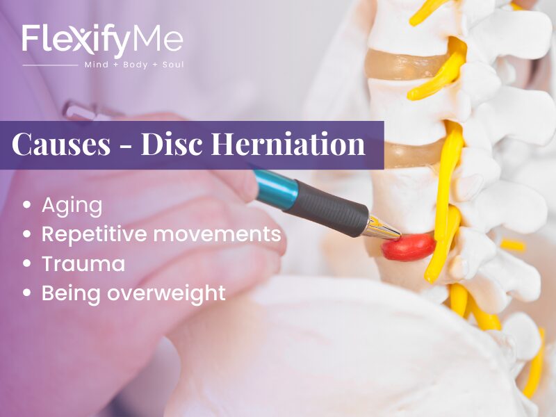 Disc Herniation Causes