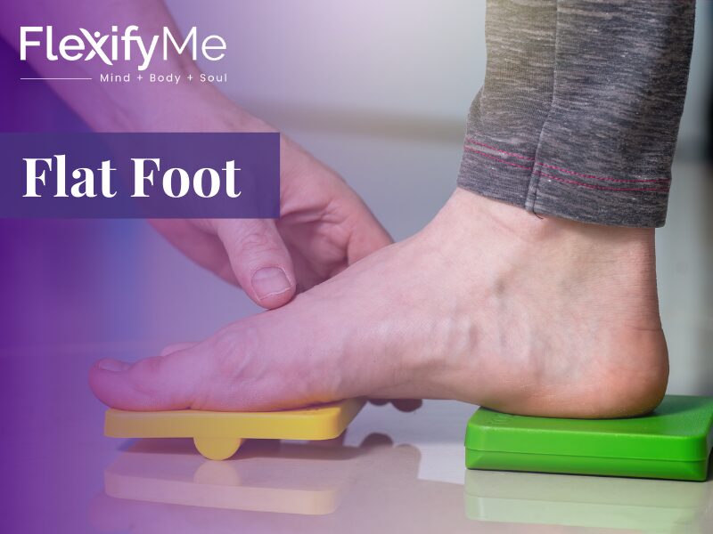 Flat Foot