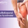 Patellofemoral Pain Syndrome