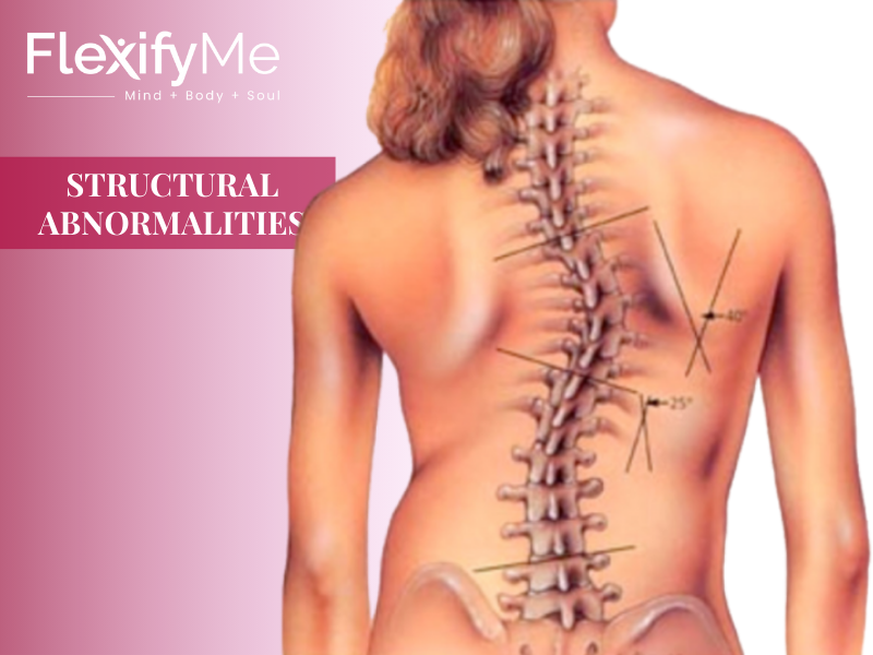 Structural Abnormalities