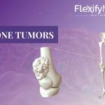 bone tumors