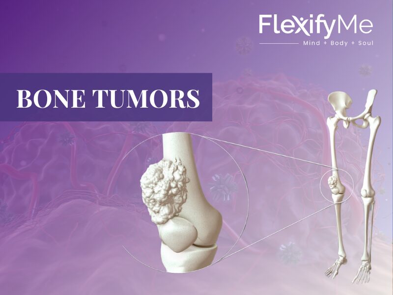 bone tumors