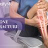 Bone Fracture