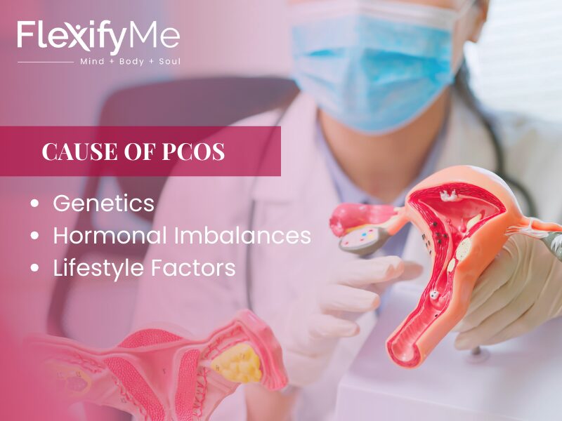 Causes of PCOS