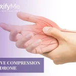 Nerve-Compression-Syndrome