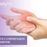 Nerve-Compression-Syndrome