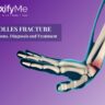 Colles Fracture