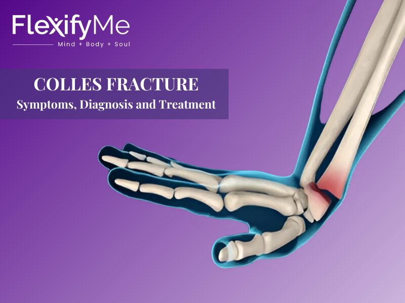 Colles Fracture