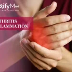Arthritis Inflammation