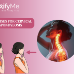 Exercises for Cervical Spondylosis