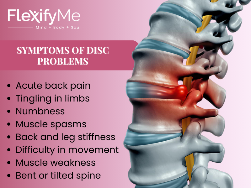 Symptoms of Disc Problems