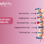 Types of Disc Problems