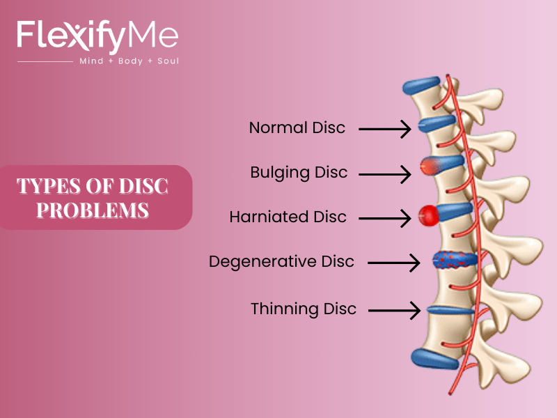 Types of Disc Problems