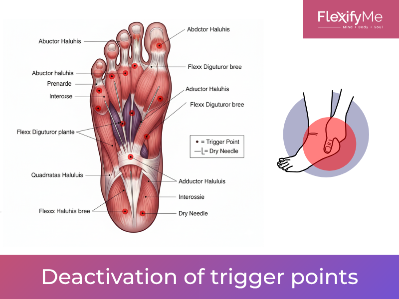 Deactivation of trigger points: