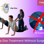 Slip Disc Treatment Without Surgery